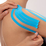 Taping Kinesiologico in Fisioterapia a Milano